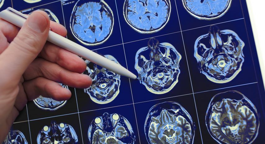¿Qué es la radioterapia?